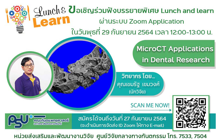 ขอเชิญผู้สนใจร่วมฟังบรรยายพิเศษ Lunch and Learn หัวข้อ “MicroCT Applications in Dental Research” โดย คุณเขมรัฐ เขมวงศ์