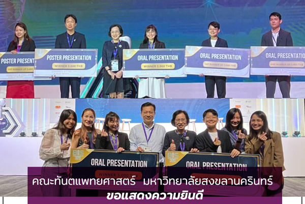 ขอแสดงความยินดีกับ คณาจารย์และนักศึกษาหลังปริญญา สาขาศัลยศาสตร์ช่องปากและแม็กซิลโลเฟเชียล ที่ได้รับรางวัลชนะเลิศ และรองชนะเลิศอันดับ 1 จากงานประชุมวิชาการ BIS 2022