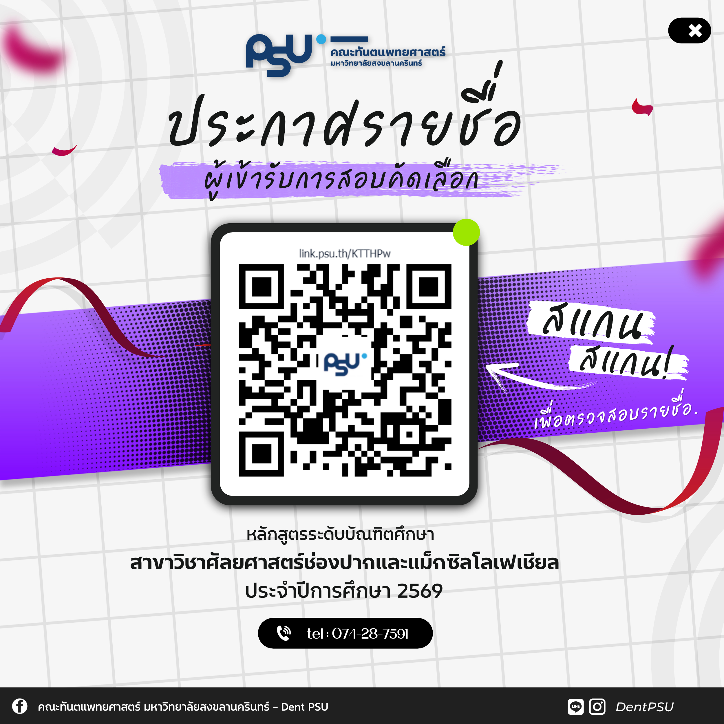 ประกาศรายชื่อผู้เข้ารับการสอบคัดเลือก หลักสูตรระดับบัณฑิตศึกษา สาขาวิชาศัลยศาสตร์ช่องปากและแม็กซิลโลเฟเชียล ปี2569