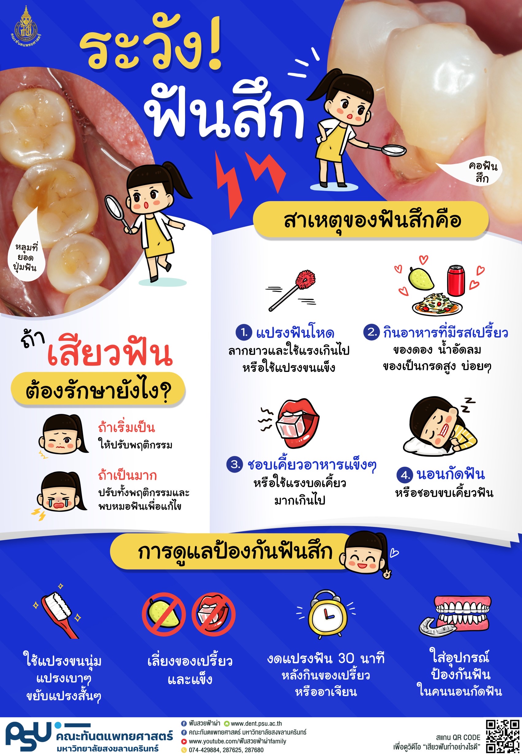 ระวังฟันสึก สาเหตุของฟันสึกคืออะไร?