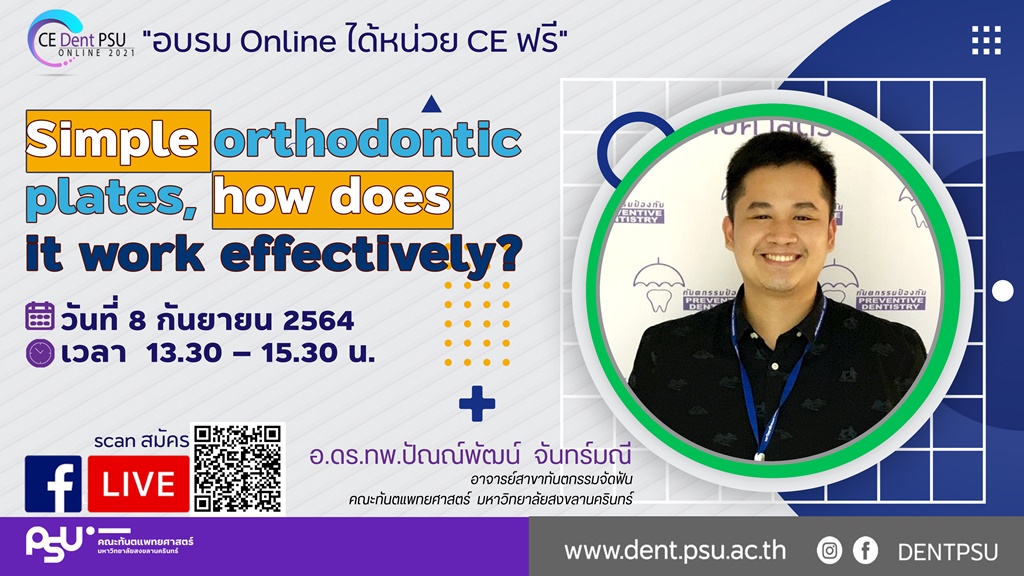วิชาการ Online 2021 ครั้งที่ 5 เรื่อง Simple orthodontic plates, how does it work effectively?